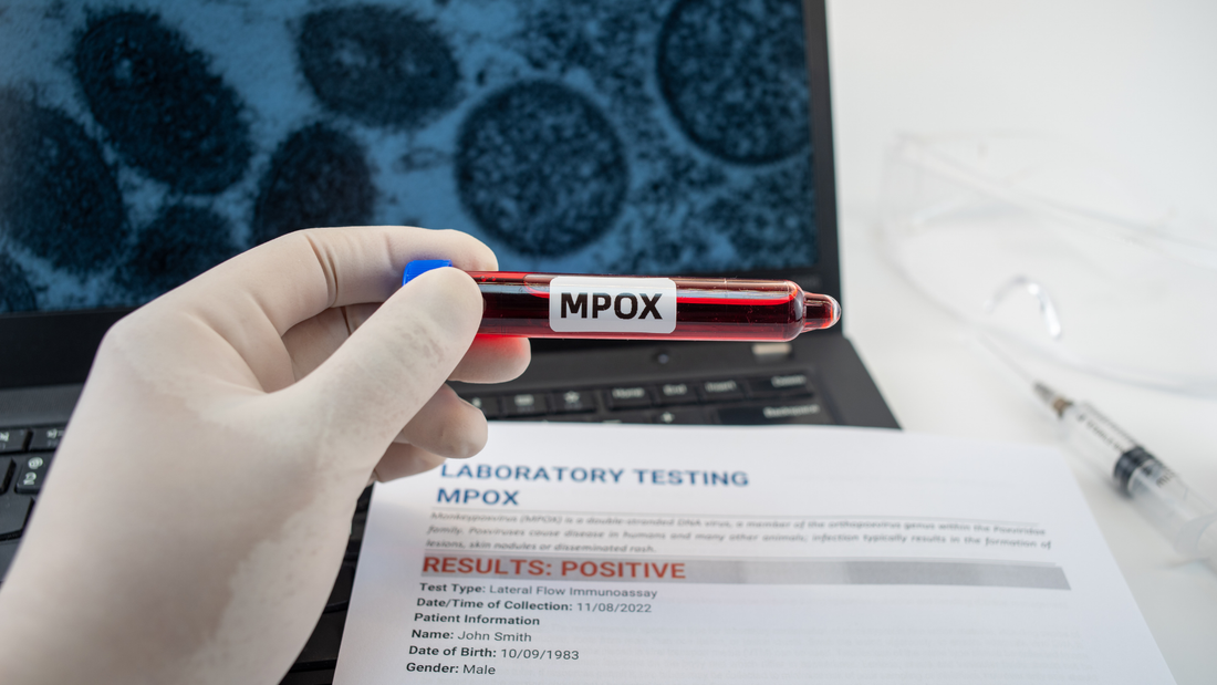 Comprehensive Insights on Mpox Transmission and Prevention Strategies